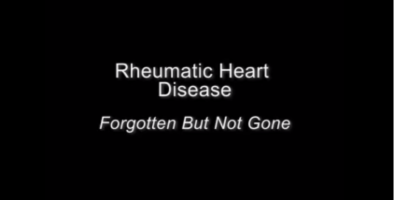 This short video includes sections of interviews with medical experts from across the globe talking about rheumatic heart disease. (includes subtitles)