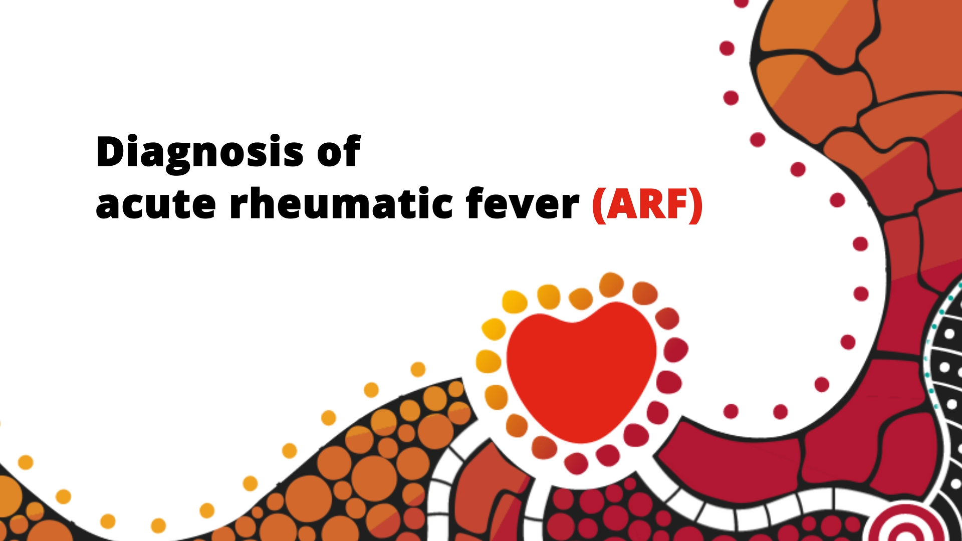 This video provides an introduction to the diagnosis of ARF in Australia and is part 2 of the Introduction to Acute Rheumatic Fever and Rheumatic Heart Disease online learning module. 