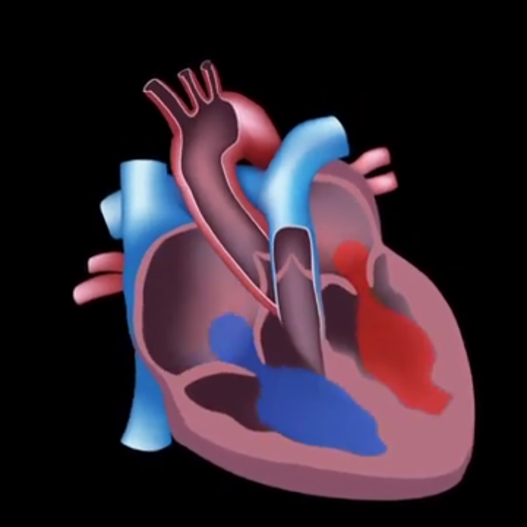 This video provides an overview of how RHD affects the heart and is part 3 of the Introduction to Acute Rheumatic Fever and Rheumatic Heart Disease online learning module. 