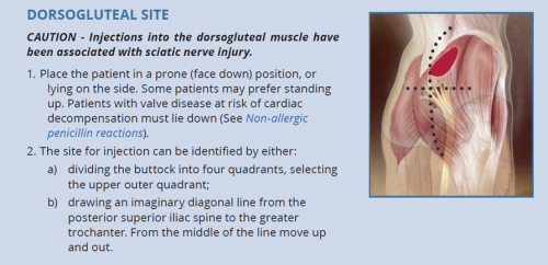 Dorsogluteal injection site - caution: injections into the dorsogluteal muscle have been associated with sciatic nerve injury