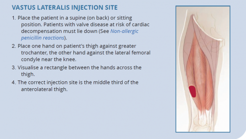 Vastus Lateralis injection site. Place the patient in the supine (on back) or sitting position.