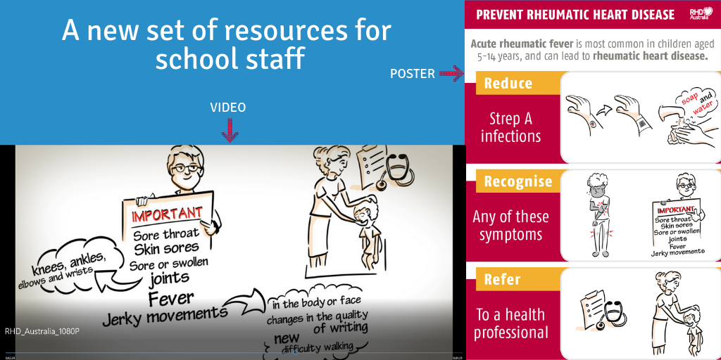 This poster and video have been developed to provide an overview of acute rheumatic fever and rheumatic heart disease for people working in schools. 