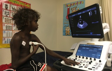 State of the art heart equipment arrives for NT kids