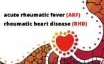This video provides an introduction to ARF and RHD in Australia and is part 1 of the Introduction to Acute Rheumatic Fever and Rheumatic Heart Disease online learning module.